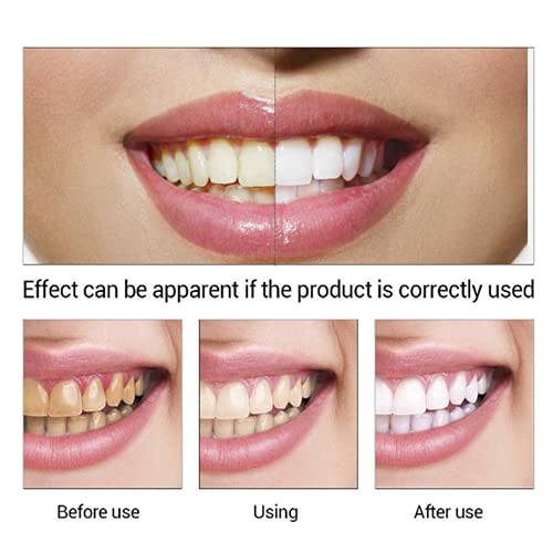 EFERO Diş Beyazlatma Özü Ağız Temizleme Ağız Hijyeni Serum Plak Lekeleri Kaldırır Diş Araçları Diş Beyazlatma Kalem Temizleme